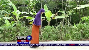 Penyakit Langka Sulami yang Dijuluki Manusia Kayu - NET 16