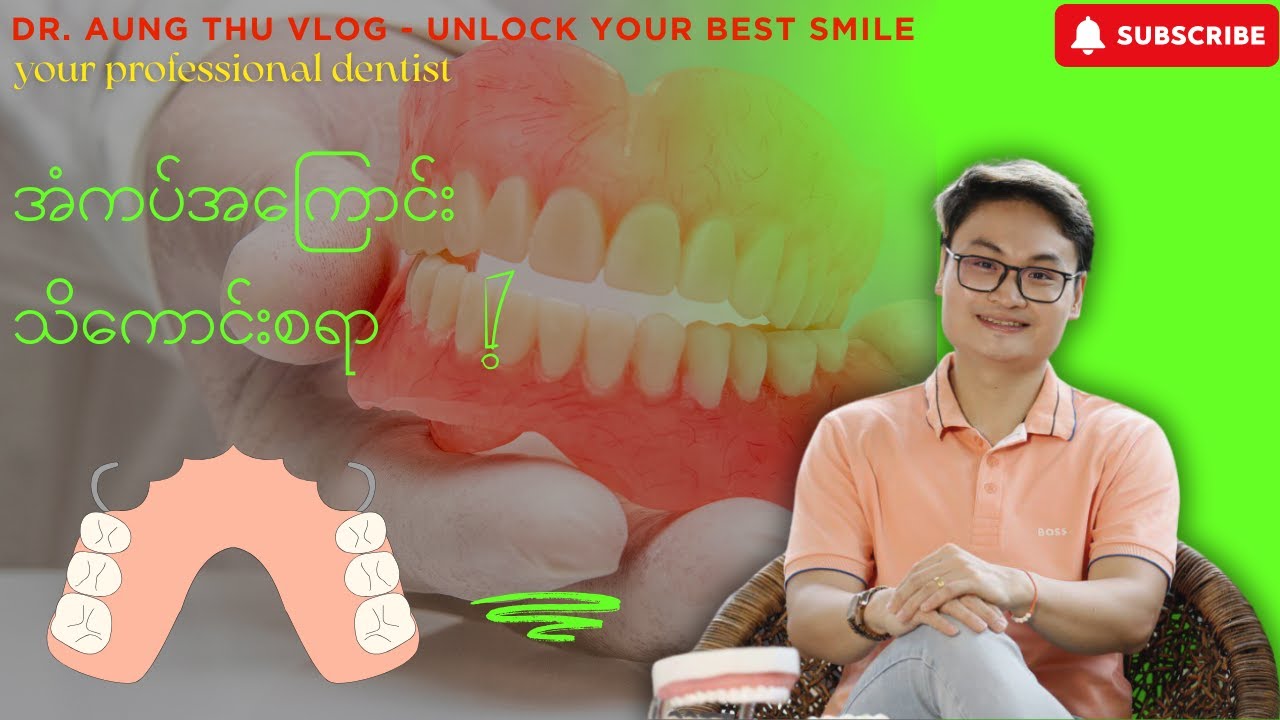 အံကပ်အကြောင်း သိကောင်းစရာ