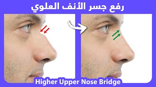 How to naturally lift the upper nose bridge area  |  رفع الجسر العلوي للأنف بطريقة طبيعية