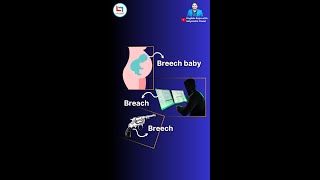 Let's learn about the homophonic pair 'breach & breech' #satyendratiwari #governmentexam #ssccglexam