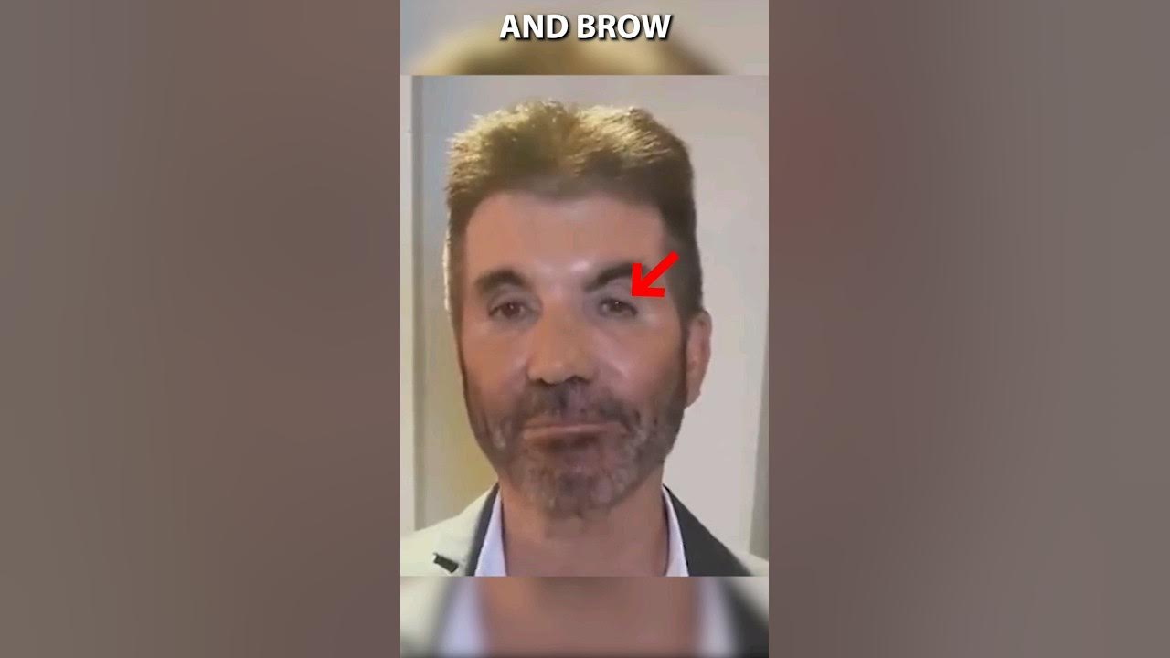 what-happened-to-simon-cowell-s-face-youtube