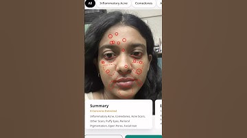 From dry skin to glowing skin | dermatologist solution | Cureskin #review #cureskin #cureskinapp