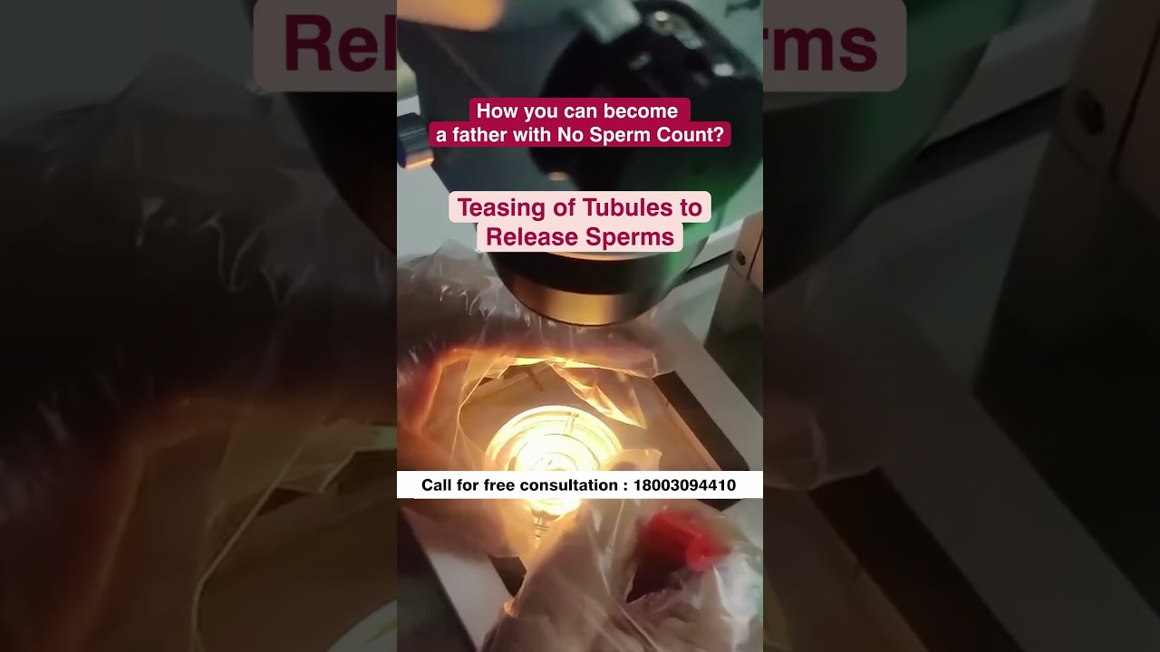 TESA is also known as Testicular Sperm Extraction.