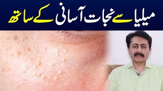Milia, Causes, Symptoms And Treatment Dr Faisal Syed