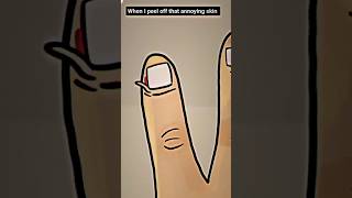 When I Peel Off That Annoying Skin