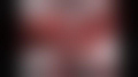 Completely Pre-Operative Planned Robotic Right S3 Segmentectomy, Assisted by 3D Reconstruction