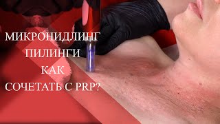 💉PRP и Микронидлинг | Лучшая процедура для дряблой кожи | Как комбинировать методику!