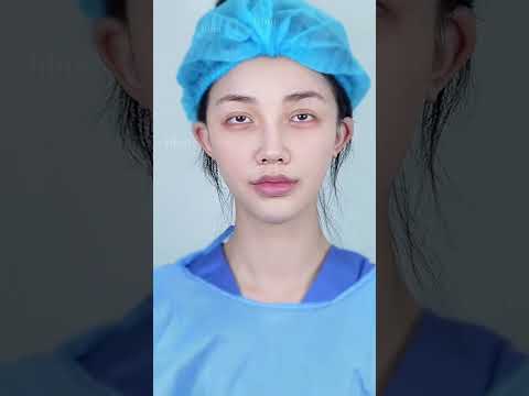 Big Eyes - Being Unkind