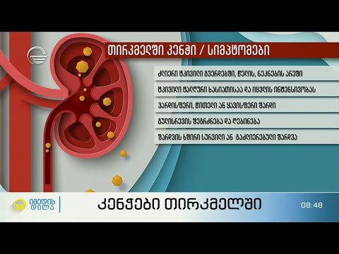 რა იწვევს თირკმელში კენჭს - სიმპტომები და დიაგნოსტიკა