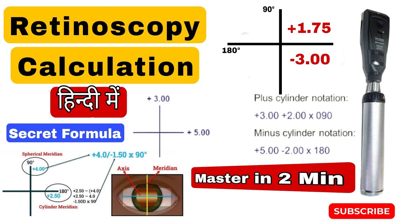 Retinoscopy Ruler Retinoscopy Calculation आसान भाषा में | Step by Step सीखें | - YouTube