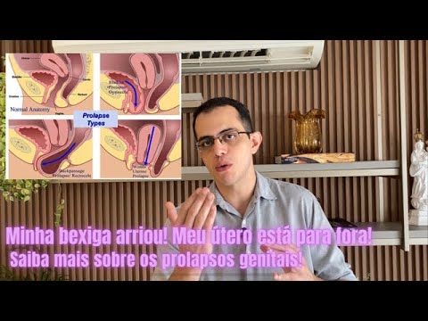 Vídeo: Os prolapsos de bexiga são comuns?