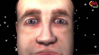 Diabetic Retinopathy 3d animation