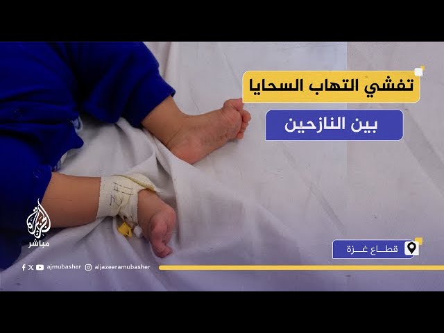 "الوضع كارثي".. تفشي خطير لالتهاب السحايا بين أطفال غزة