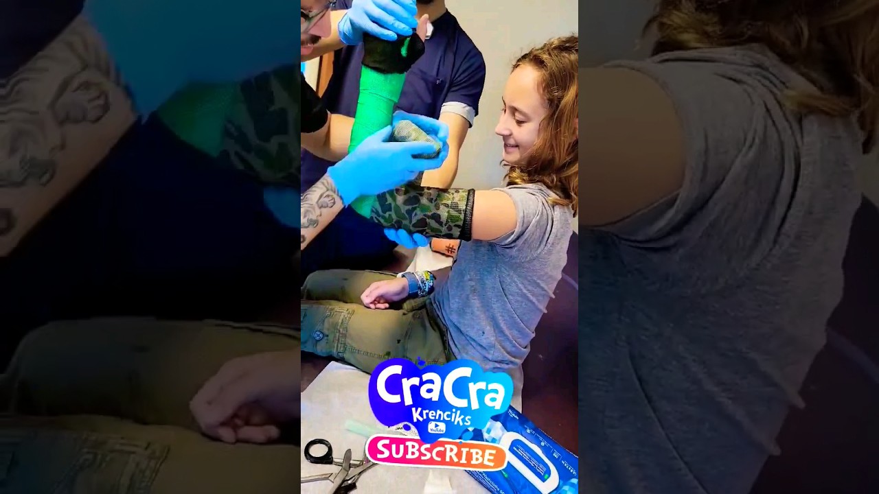 See How they install cast on my broken arm #kids #camo #howto #behindthescenes #broken #dontcry
