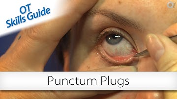 OT skills guide: punctum plugs