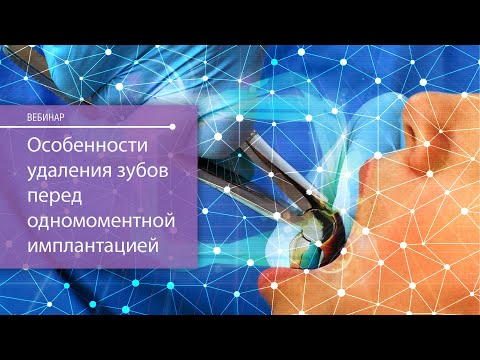 Особенности удаления зубов перед одномоментной имплантацией