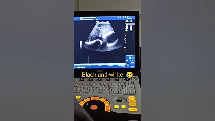 Radiologist 😥 vs other Doctors #radiologist #radiologistlife #drkaushik #neet #neet2023 #shorts