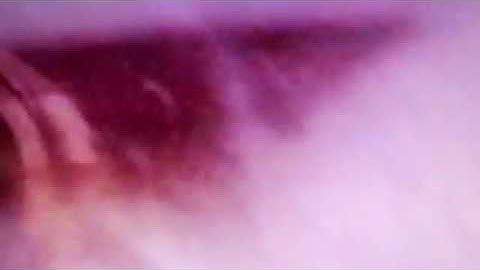 Hundred Year Old Man - Disconnect (Official Video)