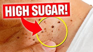 Your SKIN Is Warning YOU About Your Health! - (7 Signs To Lookout For)