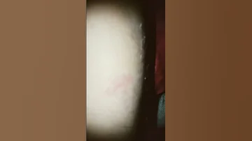 It S Just A Scar Now Shorts 