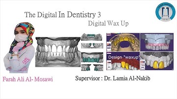 Digital Wax Up  For Smile Design 3D  الشمع الرقمي لطب الاسنان