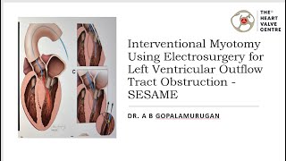 Interventional Myotomy Using Electrosurgery for Left Ventricular Outflow Tract Obstruction - SESAME