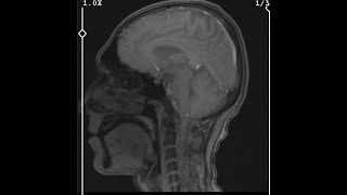 Akrav - X Time Lyrical Video Prod By Prodemite