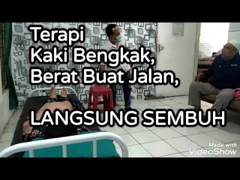 Terapi kencing manis dan kaki bengkak sembuh - YouTube