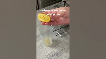 طريقة سريعة للتخلص من ألم الرأس 