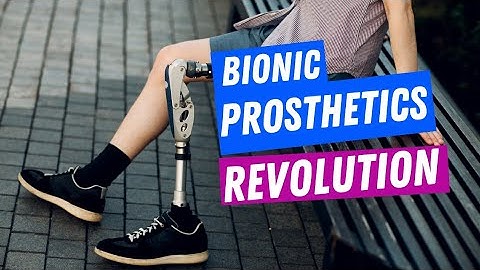 Bionic Limbs: Revolutionizing Prosthetics
