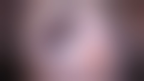 IOL Exchange of a dislocated IOL/Capsular Bag Complex and Recovery of Sommering Ring Fragment