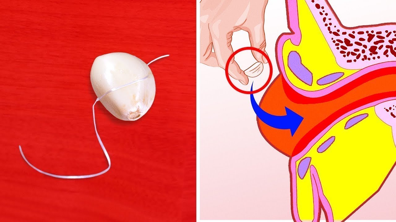 Astuce santé: pour quelle raison faut il toujours écraser l'ail avant de le  manger