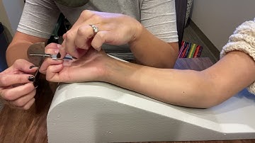 Measuring DIP Flexion: ROM and MMT