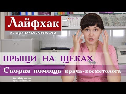 Прыщи на щеках. Лайфхак от врача косметолога