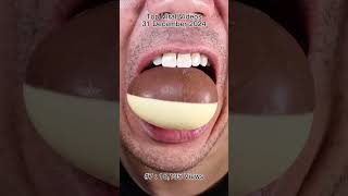 Satisfying Chewing ASMR #Compilation #ASMR #DoctorTristanPeh