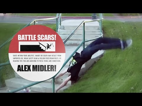 Alex Midler's Battle Scars