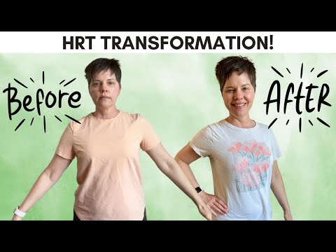 How Safe Is Keto Gummies? A Deep Dive into Potential Risks