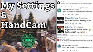 My Settings & Handcam : Xbox Diamond -Rainbow Six Siege Gameplay