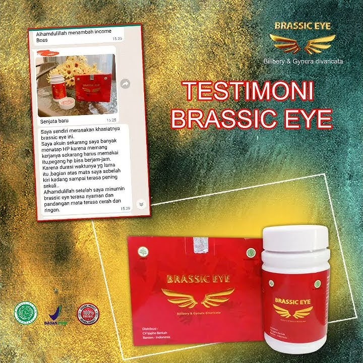 Download lagu MATA MINUS, BERAIR, BRASSIC EYE SOLUSINYA || MEDAN WA 0813 7022 1980