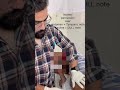 Shifting dullness in Ascites patient #percussion #ascites #neet2025 #education #educationalvideo