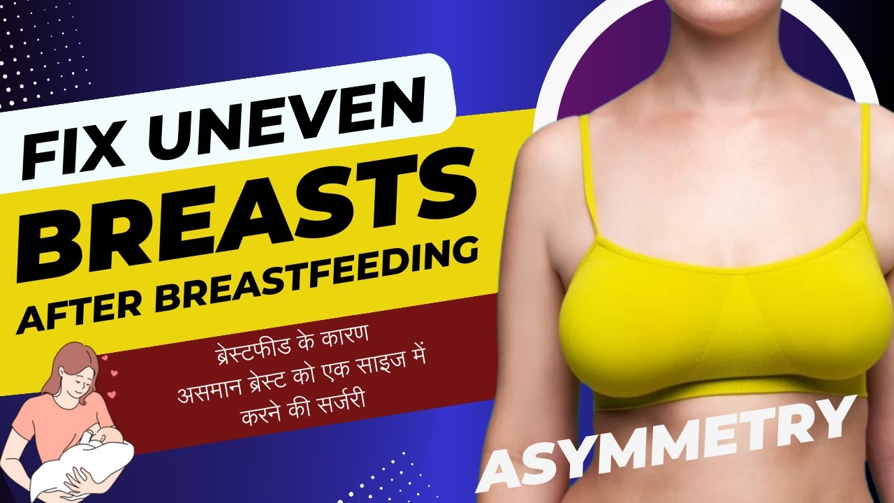 Fix Uneven Breasts after Breastfeeding, Breast Asymmetry Surgery, Fat  Injection