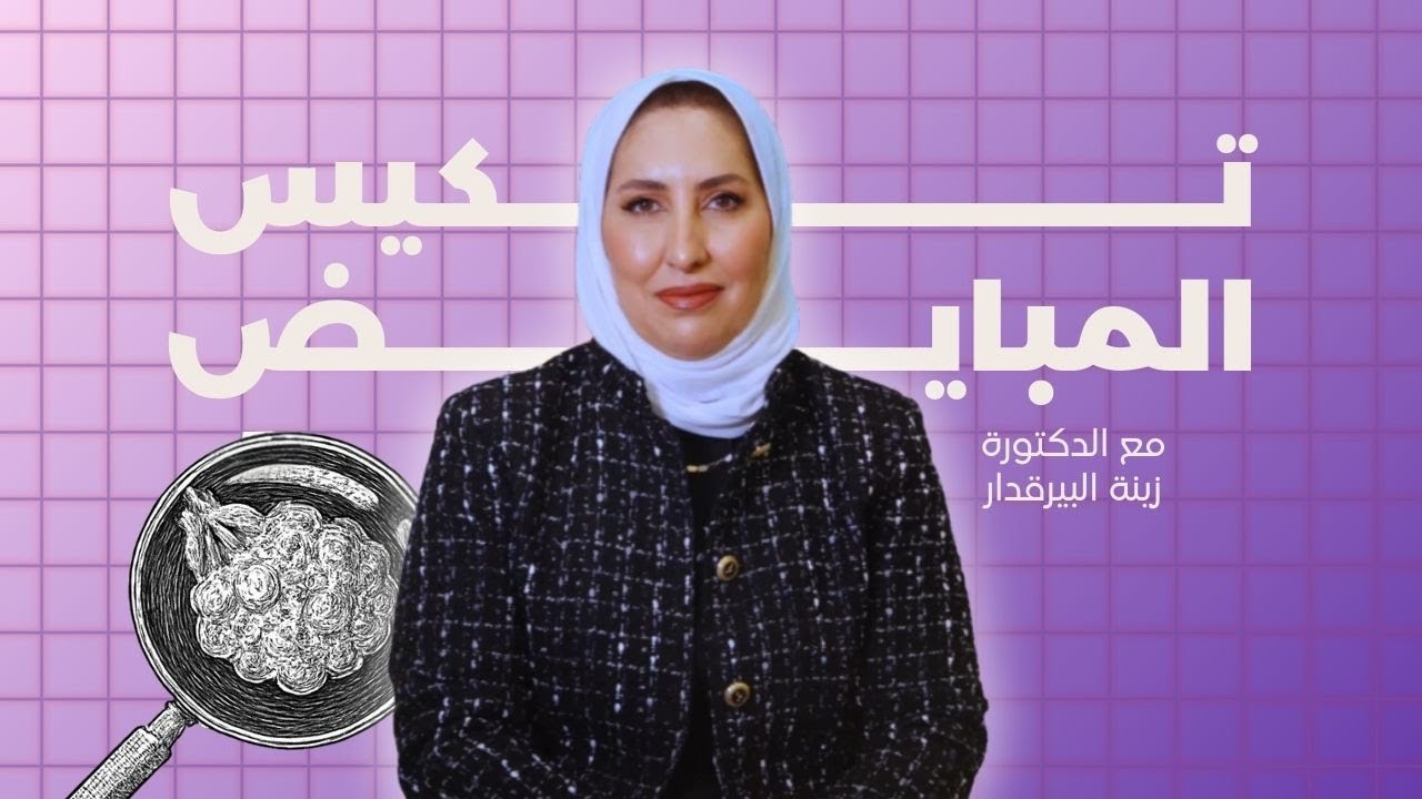 متلازمة تكيّس المبايض عند النساء: كل ما تحتاجين معرفته