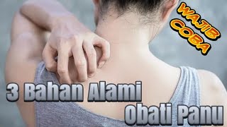 3 Cara Alami Mengobati Panu, Dijamin Mulus