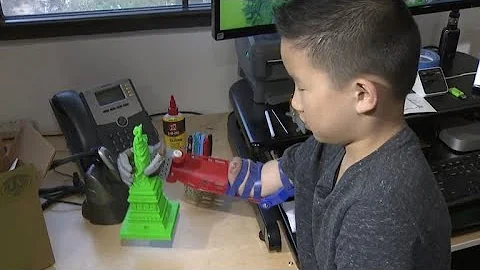 Boy born missing part of right arm gets 3-D printed prostheses