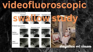 218.Videofluoroscopic Swallow Study  #VFS #dysphagia #investigation