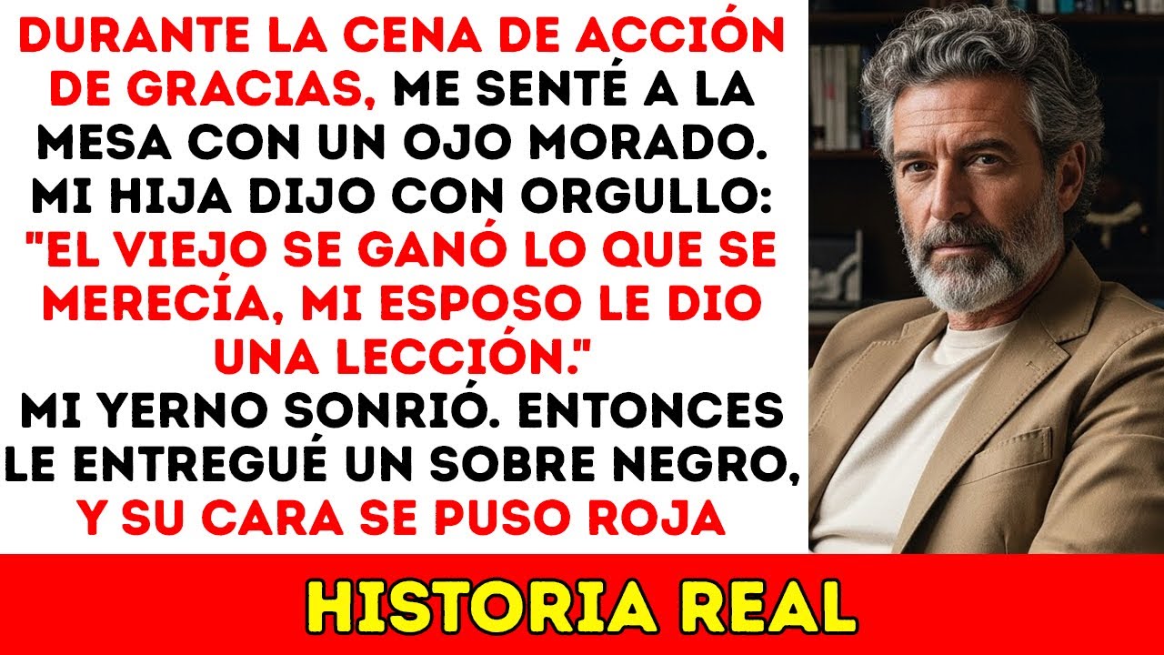 ¡Cena De Acción De Gracias: Me Planté Frente A Todos Con Un Ojo Morado. ¡Un Minuto Después…!