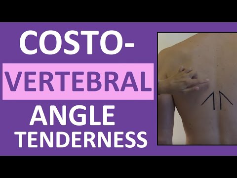 Video: Costovertebral Angle Pain: Ursachen, Behandlungen Und Mehr