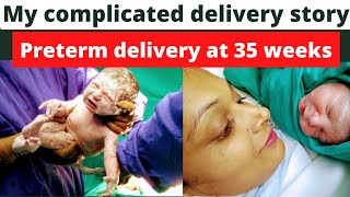 My c-section delivery story in hindi, Delivery at 35 weeks~ premature delivery with complications