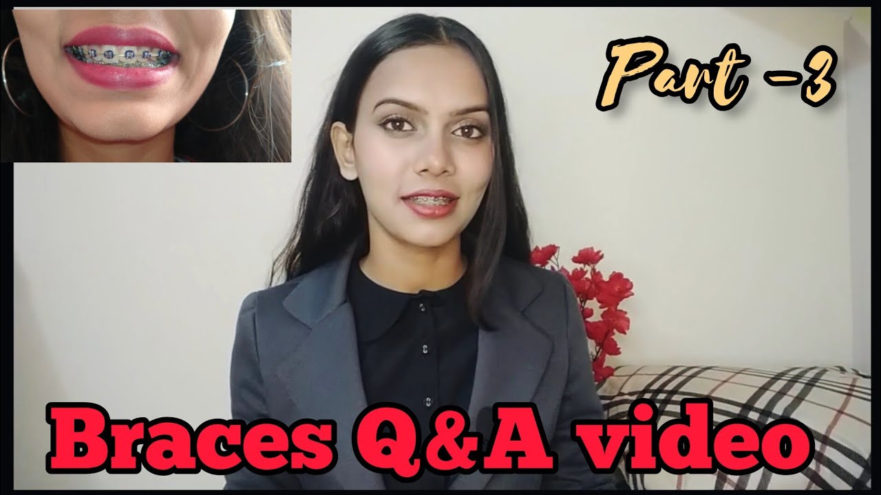 BRACES Q&A video part 3howto bracesbracesexperience 