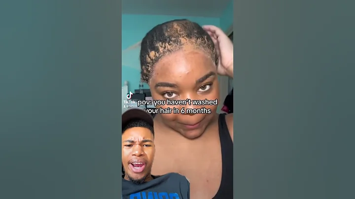 She didn’t wash her Hair for 6 Months 🤢